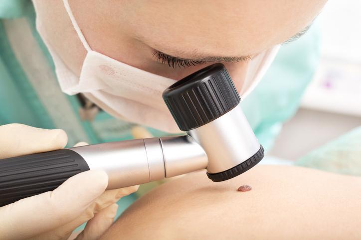 Mole & Skin Lesion Screening